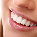 Pemutihan Gigi yang Efektif dengan Moeloet Whitening Strips