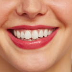 Moeloet Whitening Strips: Perawatan Gigi yang Efektif dalam 14 Hari