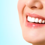 Gigi Cerah yang Tahan Lama dengan Moeloet Whitening Strips