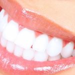 Gigi Putih dalam 10-14 Hari dengan Moeloet Whitening Strips