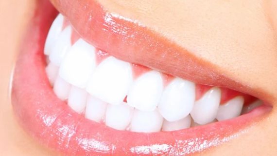 Gigi Putih dalam 10-14 Hari dengan Moeloet Whitening Strips