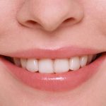 Moeloet Whitening Strips: Solusi Ampuh untuk Gigi Sensitif