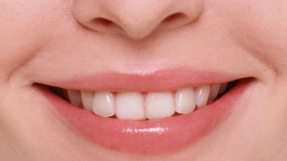 Moeloet Whitening Strips: Solusi Ampuh untuk Gigi Sensitif