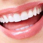 Gigi Putih Bersinar dalam 14 Hari dengan Moeloet Whitening Strips