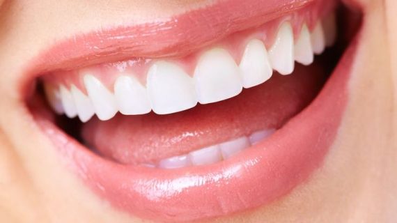 Gigi Putih Bersinar dalam 14 Hari dengan Moeloet Whitening Strips