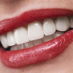 Moeloet Whitening Strips: Solusi Efektif untuk Menghilangkan Noda pada Gigi Sensitif