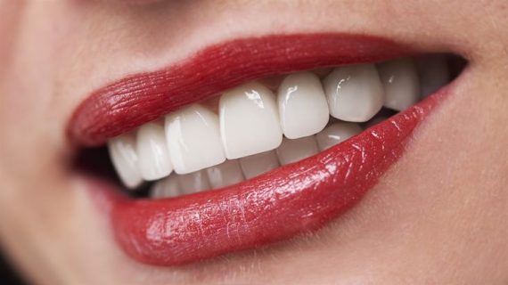 Moeloet Whitening Strips: Solusi Efektif untuk Menghilangkan Noda pada Gigi Sensitif