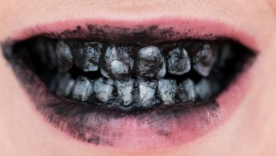 Moeloet Whitening Strips: Mencerahkan Senyuman Anda dengan Cepat