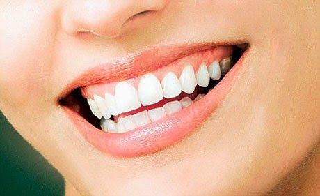 Pemutih Gigi Ajaib dalam Bentuk Foam: Moeloet Whitening Foam