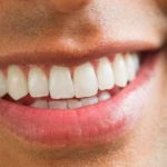 Gigi Putih yang Tahan Lama dengan Moeloet Whitening Foam: Pemakaian Rutin yang Mengagumkan