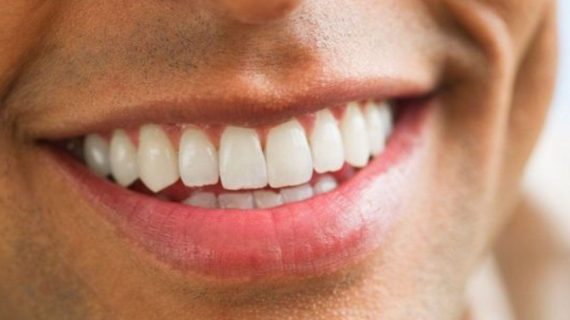 Gigi Putih yang Tahan Lama dengan Moeloet Whitening Foam: Pemakaian Rutin yang Mengagumkan