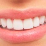 Rahasia Gigi Putih dengan Moeloet Whitening Strips