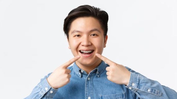 Tips Ampuh untuk Memiliki Senyuman Cerah dan Mengesankan