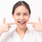 Solusi Alami untuk Mencerahkan Gigi yang Aman dan Efektif