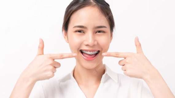 Solusi Alami untuk Mencerahkan Gigi yang Aman dan Efektif